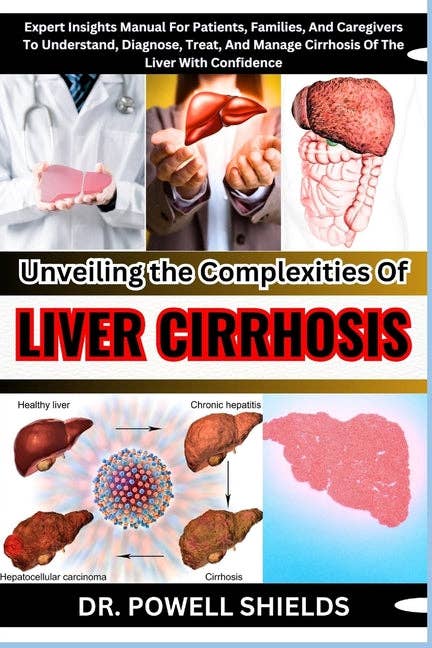 Unveiling The Complexities Of LIVER CIRRHOSIS: Expert Insights Manual For Patients, Families, And Caregivers To Understand, Diagnose, Treat, And Manag - Paperback